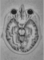Thumbnail for version as of 18:38, 28 July 2007